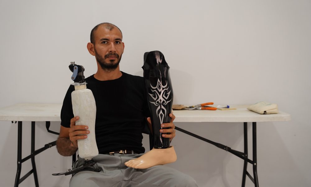 Yeison Silva entre esculturas, pinturas y prótesis